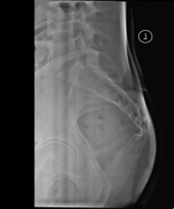 sacrum nutation x-ray